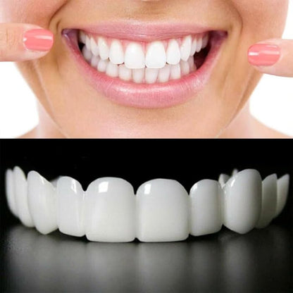 Snap On Smile Braces Teeth Kit