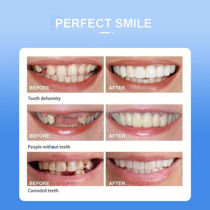 Snap On Smile Braces Teeth Kit