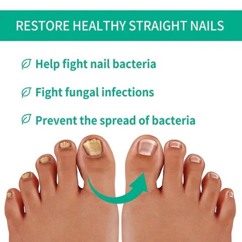 Nail Fungus Serum (MADE IN USA)