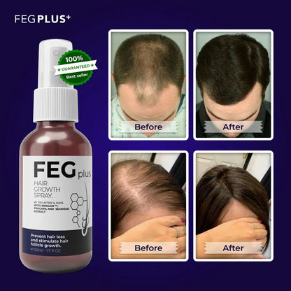 FEG Plus Beard & Hair Growth Serum Spray | 60 ML