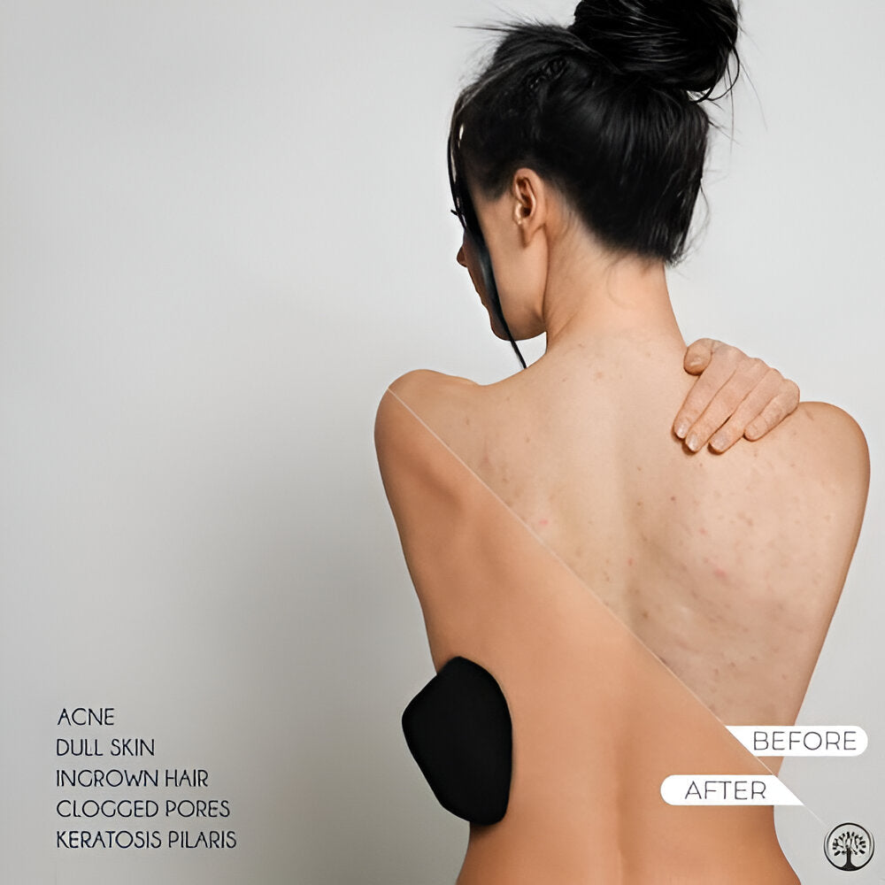 Exfoliating Gloves Dead Skin Remover - Chic Flicks Store