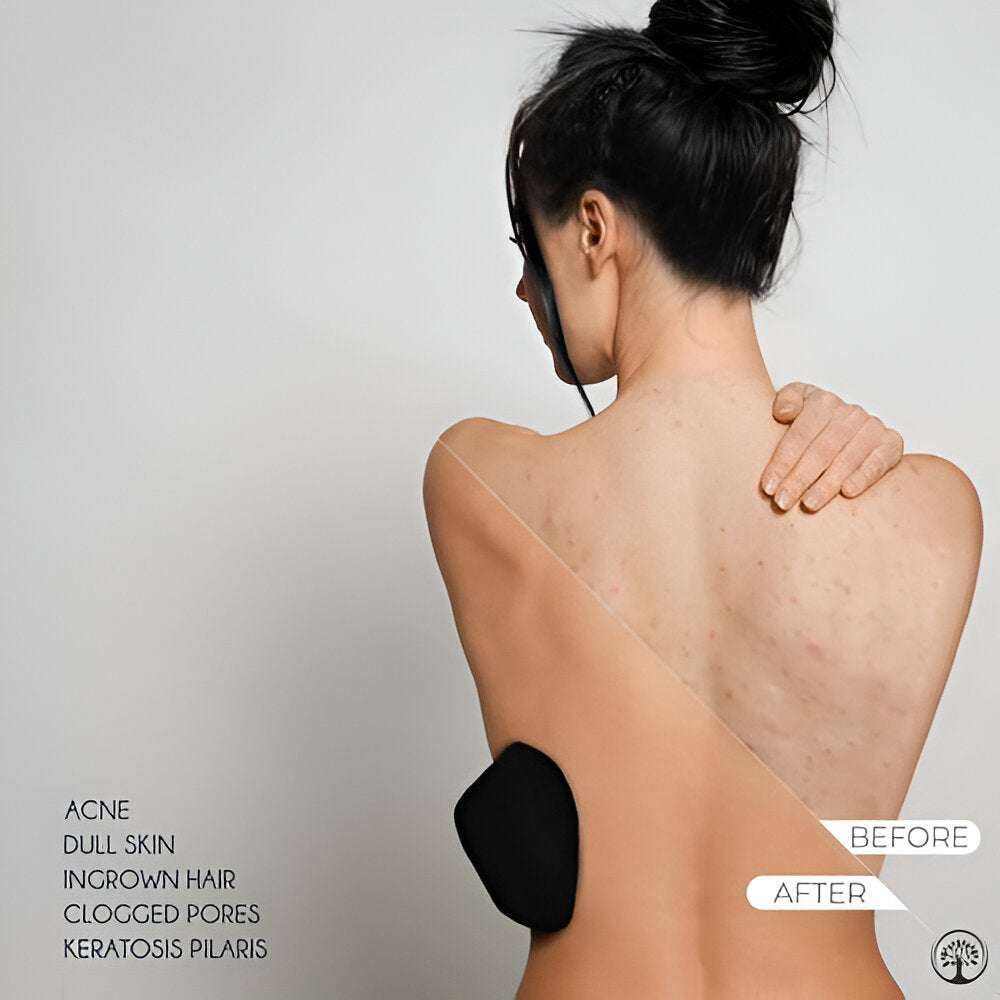 Exfoliating Gloves Dead Skin Remover - Chic Flicks Store